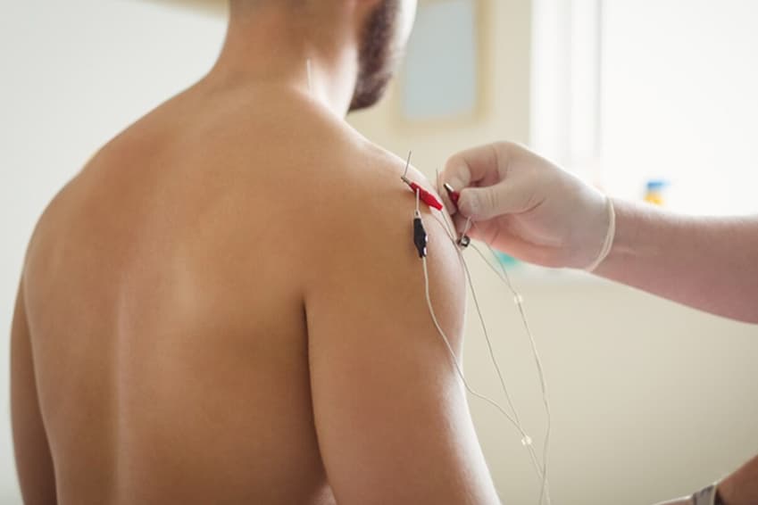 electro acupuncture 2