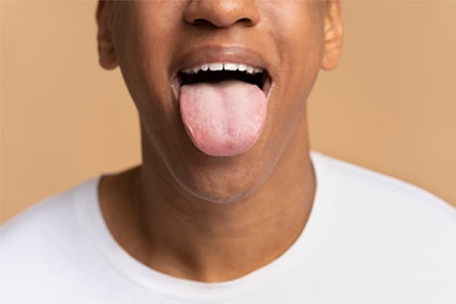 Tongue 1