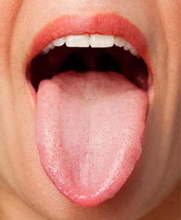 Tongue 3